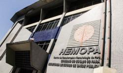 Vagas de estágio abertas no Hemopa, em Belém